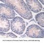 Adenosine Kinase (ADK) Antibody