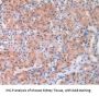 Adenosine Kinase (ADK) Antibody