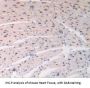 Adenosine Kinase (ADK) Antibody