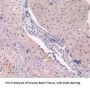 Adenosine Kinase (ADK) Antibody