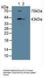Leukocyte Elastase Inhibitor (SERPINB1) Antibody