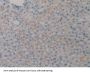 Leukocyte Elastase Inhibitor (SERPINB1) Antibody