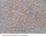 Leukocyte Elastase Inhibitor (SERPINB1) Antibody