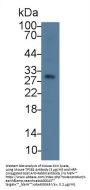 Tryptase beta 2 Antibody