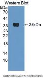 Tryptase beta 2 Antibody