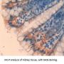 Tryptase beta 2 Antibody