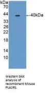Phospholipase A2 Receptor 1 (PLA2R1) Antibody