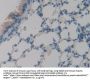 Phospholipase A2 Receptor 1 (PLA2R1) Antibody