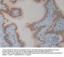 Phospholipase A2 Receptor 1 (PLA2R1) Antibody