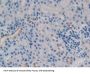 Tumor Necrosis Factor Ligand Superfamily Member 9 (TNFSF9) Antibody