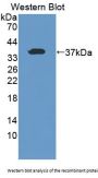Torsin 1A (TOR1A) Antibody