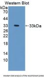 Trehalase (TREH) Antibody