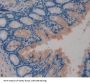 TTK Protein Kinase (TTK) Antibody