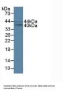 FOS Like Antigen 1 (FOSL1) Antibody