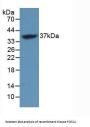 FOS Like Antigen 1 (FOSL1) Antibody