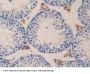 FOS Like Antigen 1 (FOSL1) Antibody
