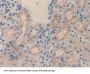 FOS Like Antigen 1 (FOSL1) Antibody