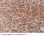 FOS Like Antigen 1 (FOSL1) Antibody