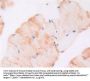 Glycoprotein 130 Antibody