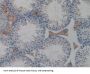Galectin 4 (LGALS4) Antibody