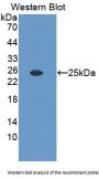 Interleukin 35 (IL35) Antibody