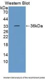 Ephrin Type B Receptor 3 (EPHB3) Antibody