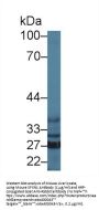 Sideroflexin 1 (SFXN1) Antibody