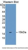 Sideroflexin 1 (SFXN1) Antibody