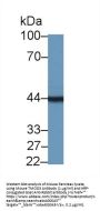 Tropomodulin 3 (TMOD3) Antibody