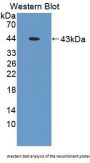 Tropomodulin 3 (TMOD3) Antibody