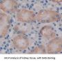 Tropomodulin 3 (TMOD3) Antibody