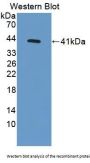 Microseminoprotein beta Antibody