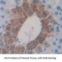 Microseminoprotein beta Antibody