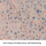 Amiloride Sensitive Sodium Channel Subunit Alpha (SCNN1a) Antibody