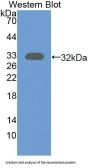 N-Acetyltransferase 1 (NAT1) Antibody
