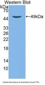 Alpha-Tocopherol Transfer Protein (TTPA) Antibody