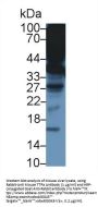Alpha-Tocopherol Transfer Protein (TTPA) Antibody