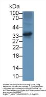 Alpha-Tocopherol Transfer Protein (TTPA) Antibody