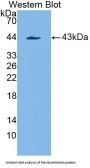 Platelet Derived Growth Factor Receptor Like Protein (PDGFRL) Antibody
