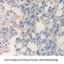 Platelet Derived Growth Factor Receptor Like Protein (PDGFRL) Antibody