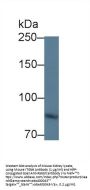 Integrin Beta 6 (ITGb6) Antibody