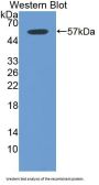 Integrin Beta 6 (ITGb6) Antibody