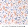 Integrin Beta 6 (ITGb6) Antibody