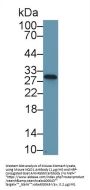 NAD(P)H Dehydrogenase, Quinone 1 (NQO1) Antibody
