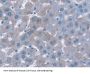 NAD(P)H Dehydrogenase, Quinone 1 (NQO1) Antibody