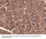 Myoglobin (MB) Antibody