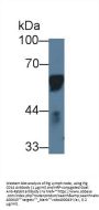 Cluster Of Differentiation 14 (CD14) Antibody
