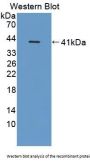 Cluster Of Differentiation 14 (CD14) Antibody