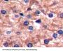 Cluster Of Differentiation 14 (CD14) Antibody