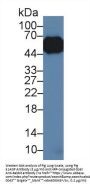 Alpha-1-Acid Glycoprotein (a1AGP) Antibody